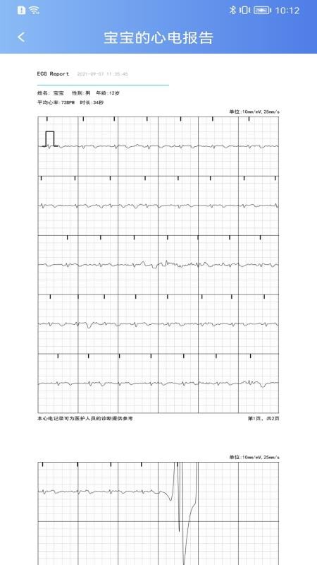 卡帕奇心电官网版v1.1.0.6截图5